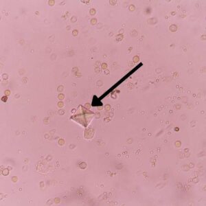 cristaux d'oxalate dans les urines d'un chat qui fait une cystite