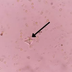 cristaux urinaires chez un chat qui souffre de cystite